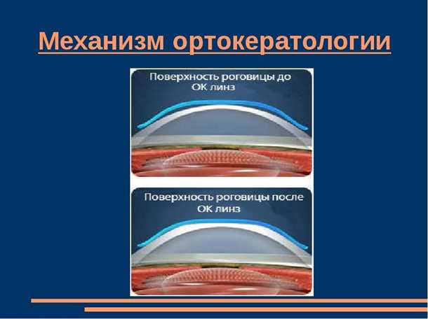 Посещение оптика или врача-офтальмолога