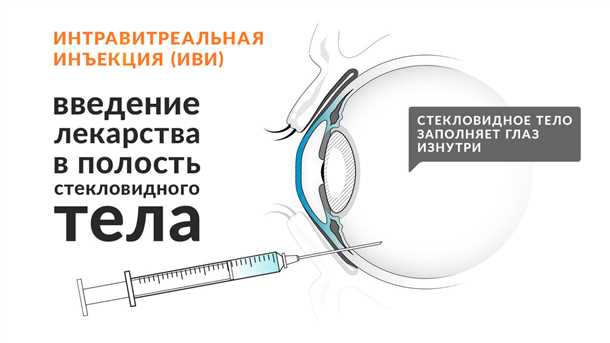 Повреждение сетчатки