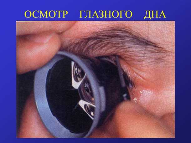 1. Какие методы используются для осмотра глазного дна?