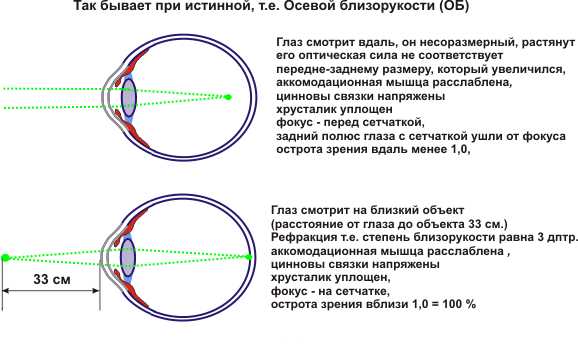 Первичное измерение остроты зрения