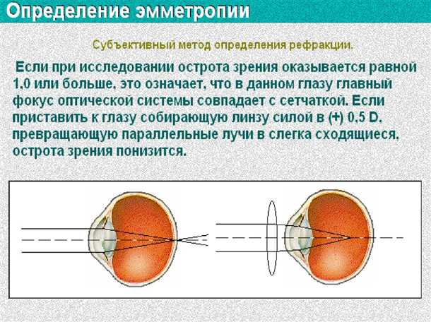 Острота зрения