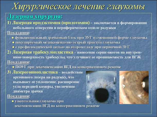 Хирургическое лечение