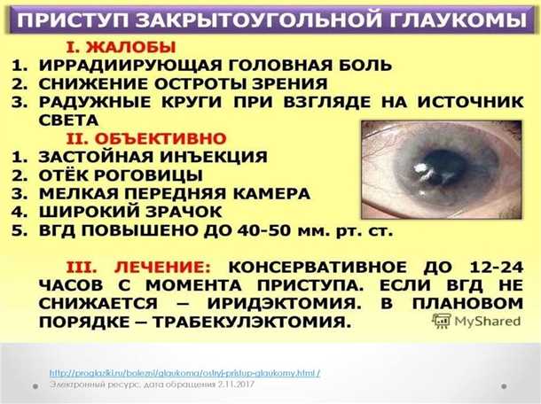 Диагностика глаукомы