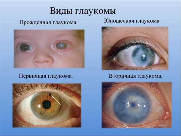 3. Поля зрения