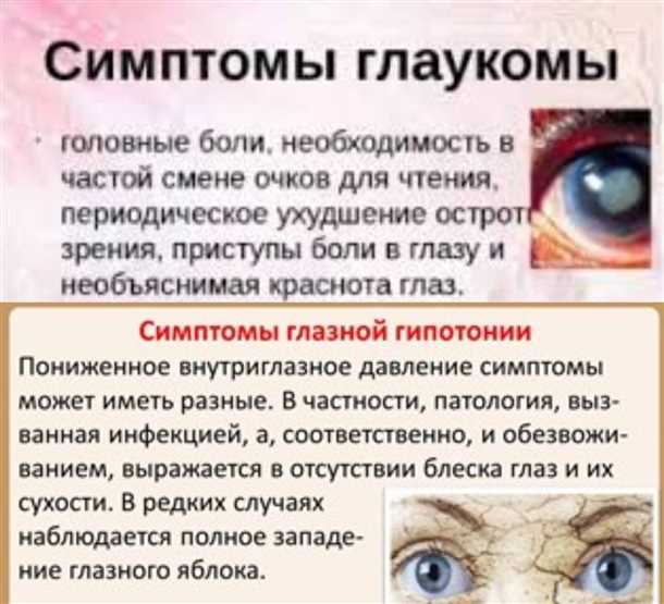 Причины глаукомы