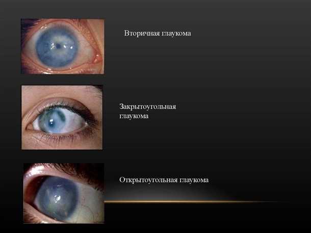 2. Оптическая когерентная томография (ОКТ)
