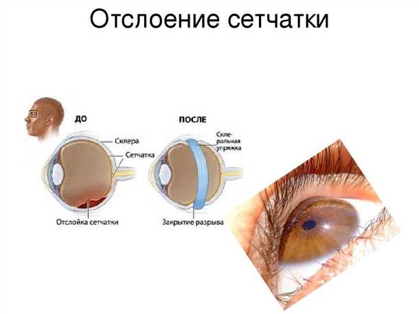 3. Профилактика и здоровый образ жизни