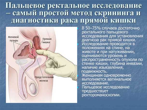 Проктит