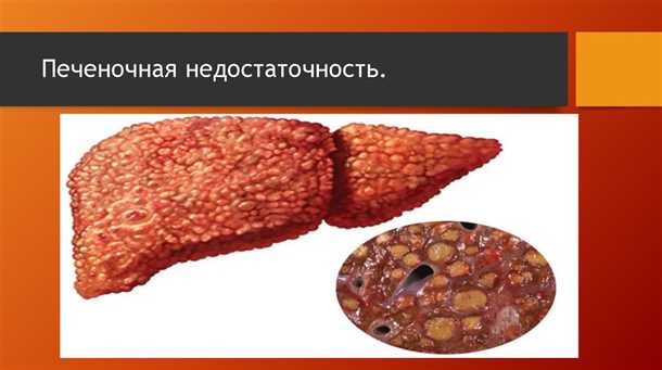Паразиты в печени человека симптомы и лечение