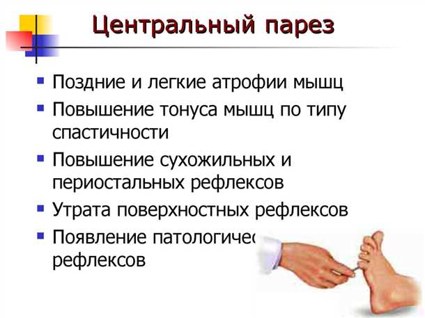 Парез: симптомы, причины и методы лечения | Медицинская Энциклопедия