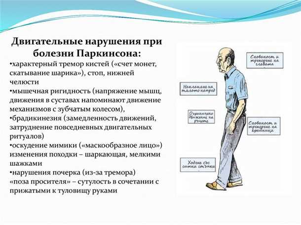 Комплексное лечение паркинсонизма и деменции: подходы и эффективность