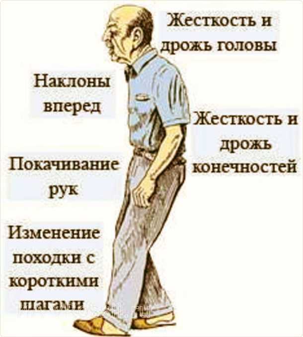 Основные симптомы и проявления паркинсонизма