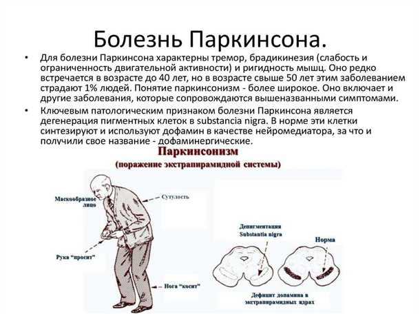Тяжелые металлы