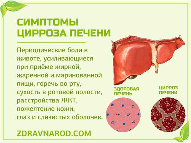 2. Предпочитайте легкоусвояемую пищу