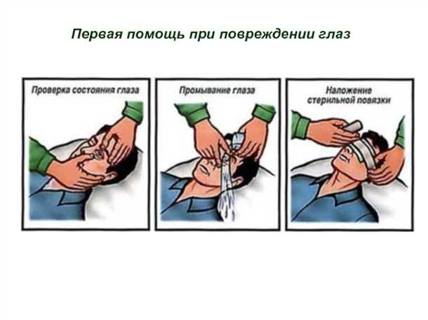 Виды травмы глаза