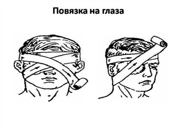 Что делать, если глаз порезан