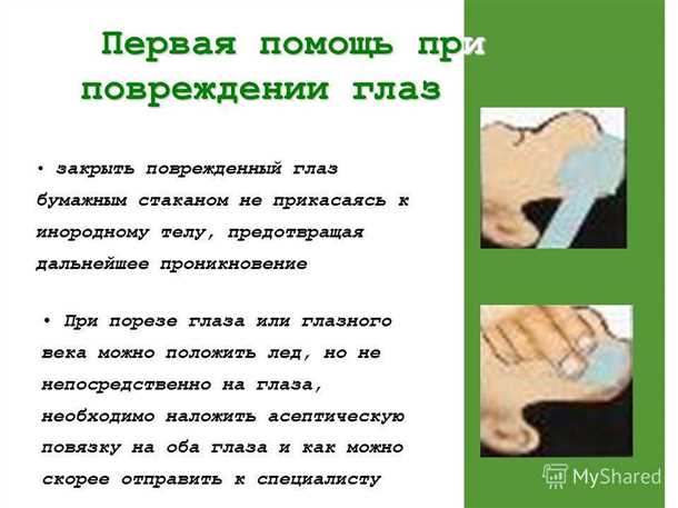 Первая помощь при травме глаза | Медицинская Энциклопедия