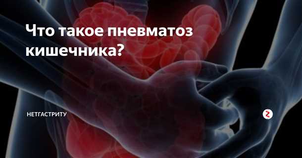 Повышайте потребление растворимых волокон