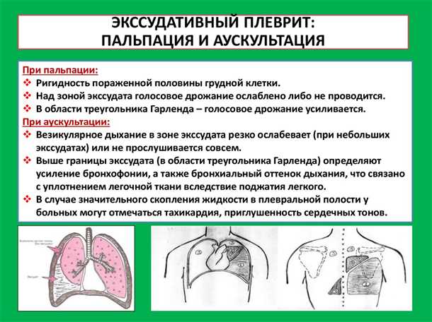 Пневмониты и плевриты с неврологическими симптомами.