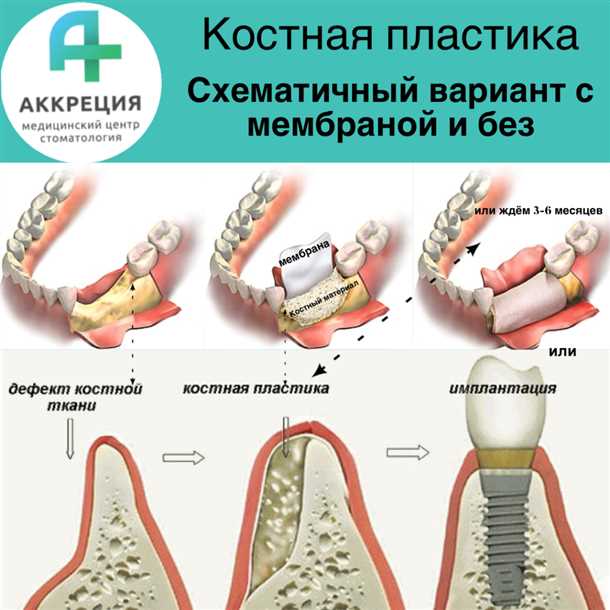 2. Повышение эстетического результата