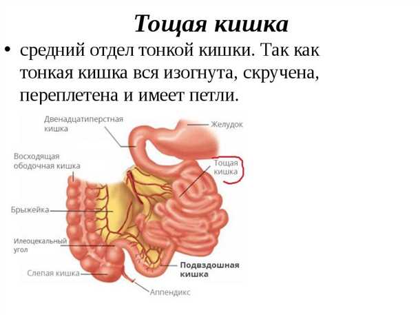 Заболевания подвздошной кишки