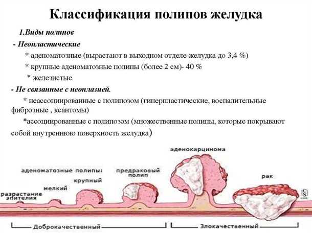 2. Ректороманоскопия