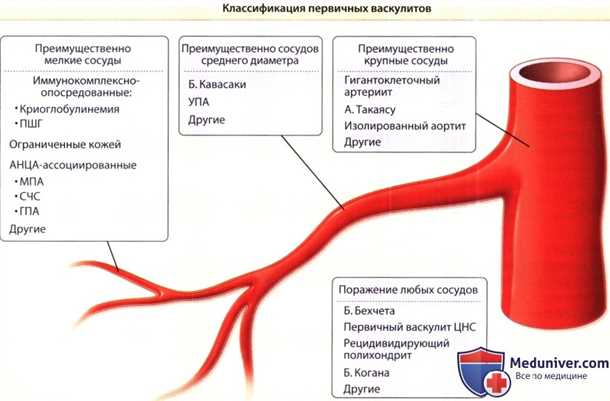 Основные виды и проявления васкулитов