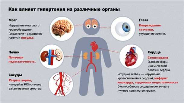 Нарушения церебрального кровообращения