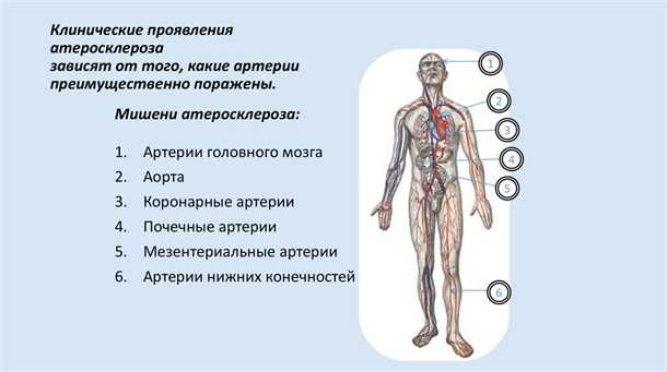 Атеросклеротический нейропатический синдром: симптомы и диагностика