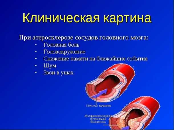 1. Потеря чувствительности и паралич
