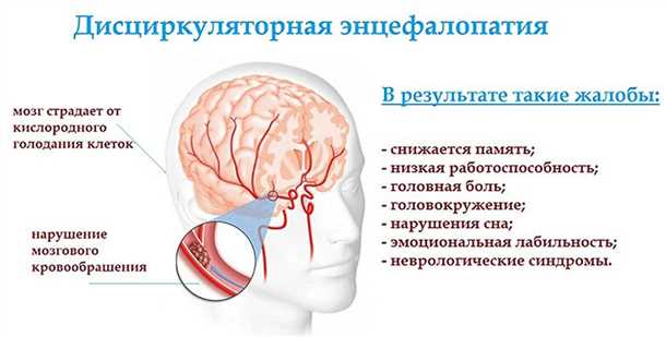 Сенсорные нарушения