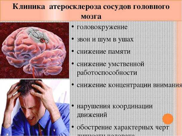 Поражения нервной системы при атеросклерозе сосудов.