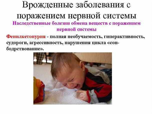 Муковисцидоз: наследственное заболевание с трагическим исходом