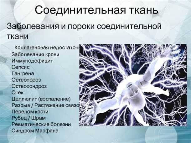 Поражения нервной системы при системных заболеваниях соединительной ткани.