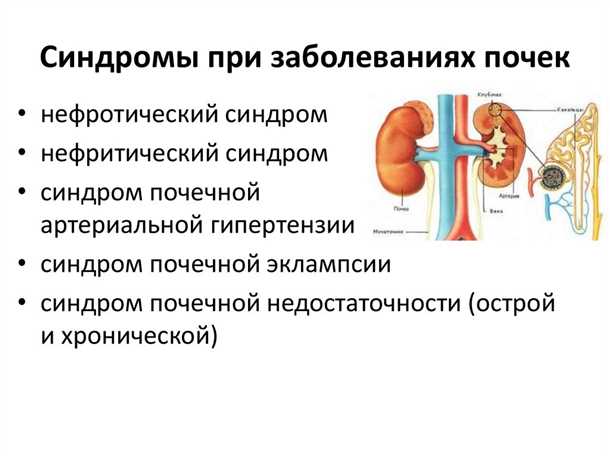 Прогрессирующая диабетическая ретинопатия