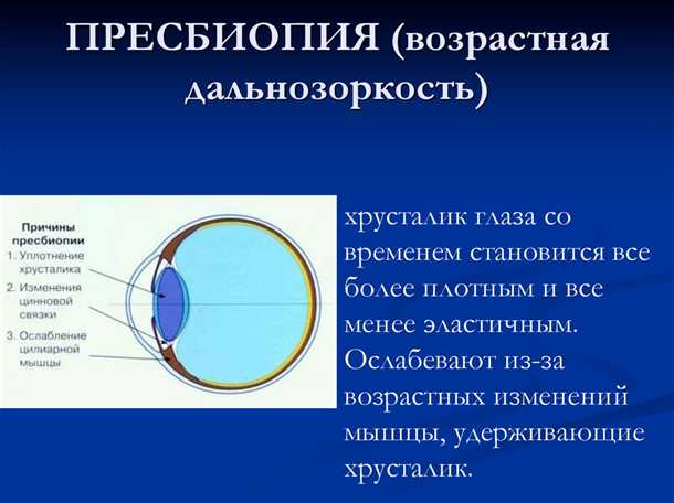 Пресбиопия - возрастные изменения глаза