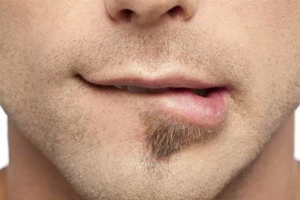 Типичные стоматологические патологии, вызывающие прикус губ