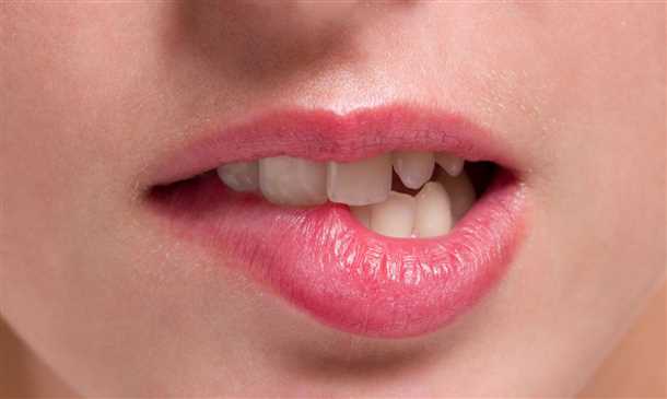 Лечение прикуса губы