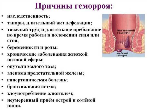 11. Какие причины могут привести к развитию геморроя у мужчин?