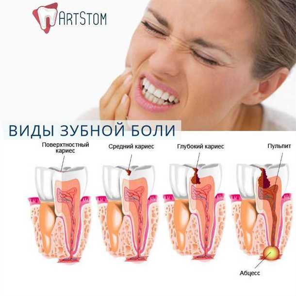 Рекомендации по профилактике: