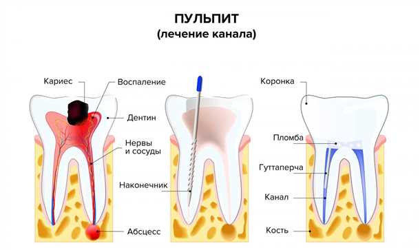 Невыносимая боль