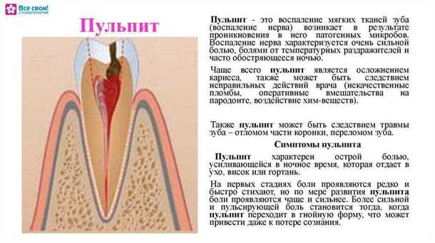 Диагностика пульсирующей боли в зубе