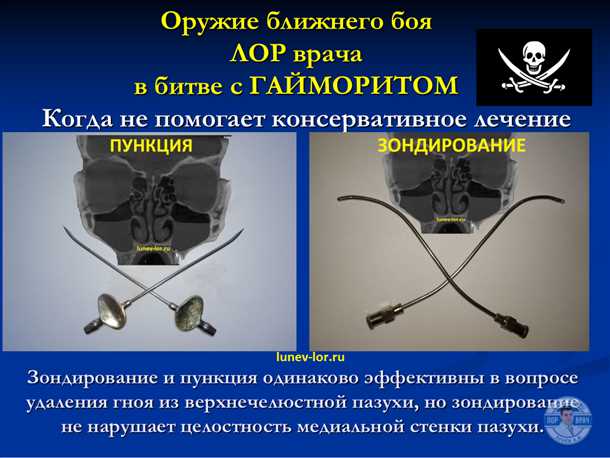 Раздел 1: Сущность и показания к процедуре