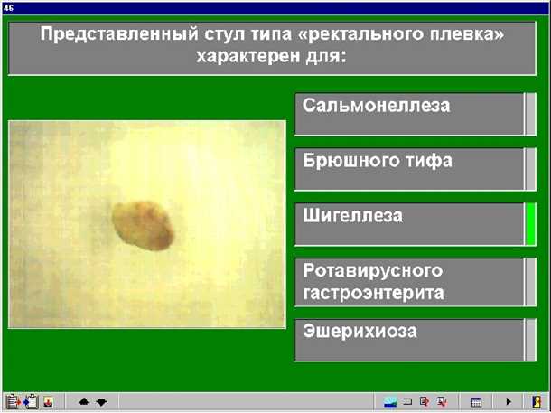 3. Кишечная инфекция
