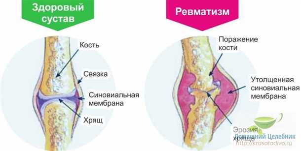 Дополнительные рекомендации:
