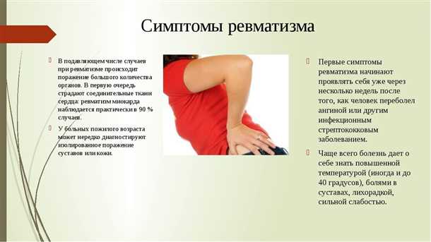 Ревматизм