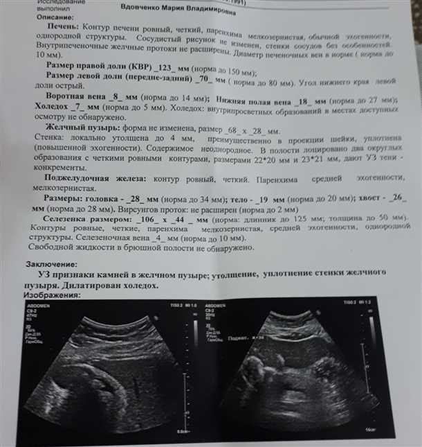 3. Рентгеновское исследование