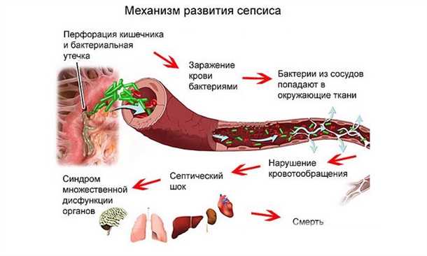 Основные принципы и методы лечения опасного инфекционного заболевания