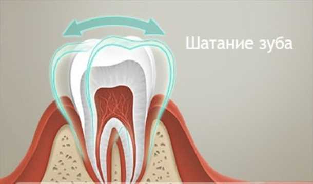 Искривление зубов