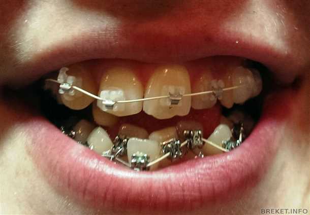 Сравнение с другими методами лечения